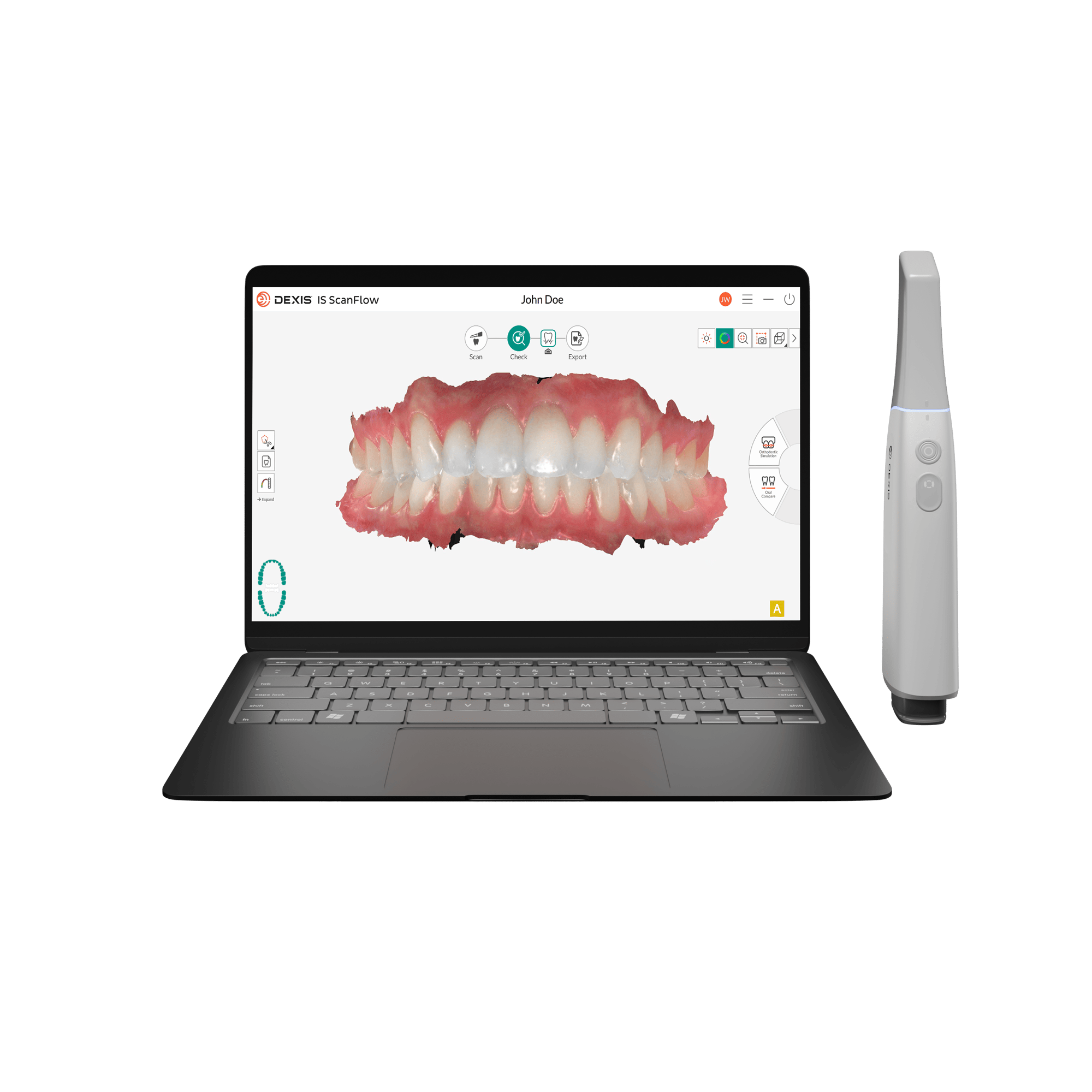 DEXIS Imprevo with Laptop (1)